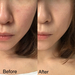 ドラッグストアにある★優秀シミ隠し「ファンデーション」10選 - @cosmeまとめ(アットコスメまとめ)